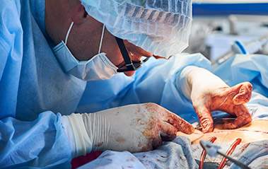 Pancreatic Surgery