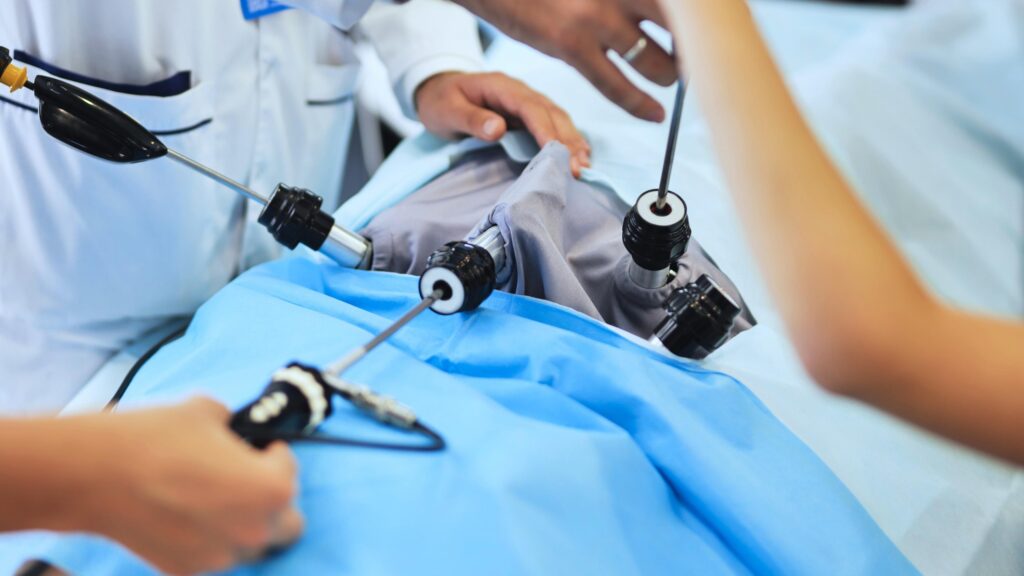 Laparoscopic surgery procedure Hyderabad minimally invasive technique